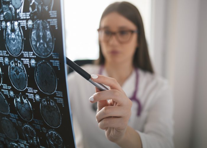 Female doctor pointing at mri brain scan