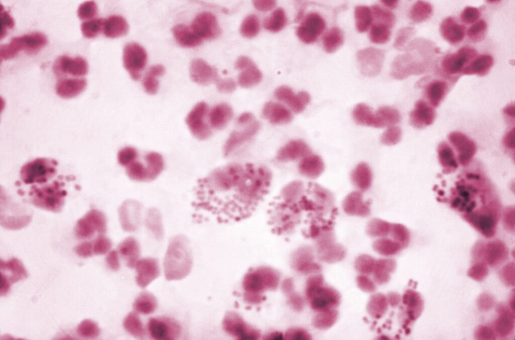 Microscopic image of Neisseria gonorrhoeae diplococcal bacteria, imaged source from CDC.