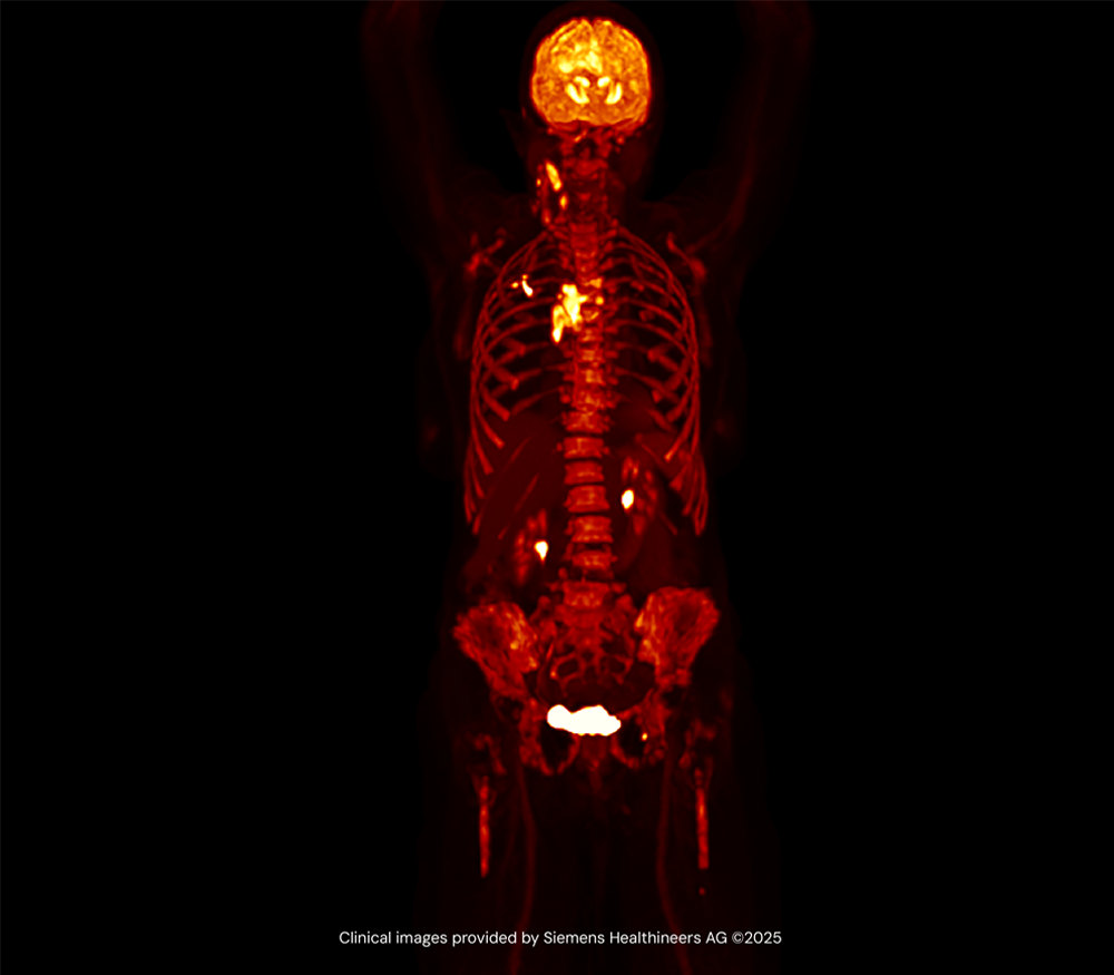 About Medicines Discovery Catapult - Medical imaging of human body anatomy