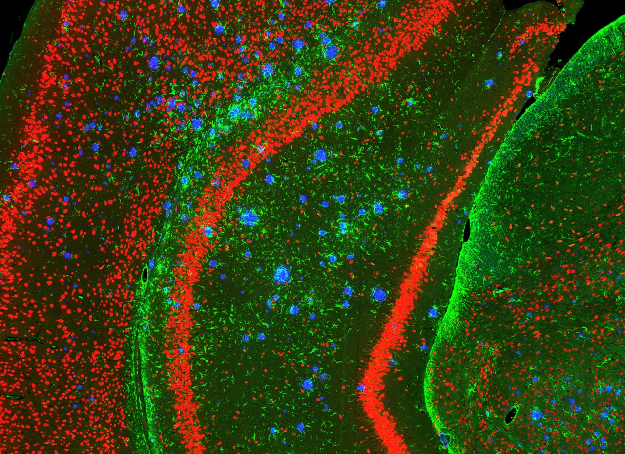 Amyloid Plaques in a 5xFAD in vivo model