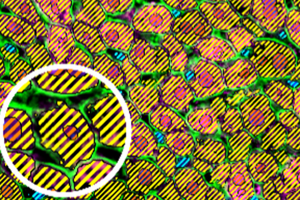 Cellular tropism microscopy liver cell image