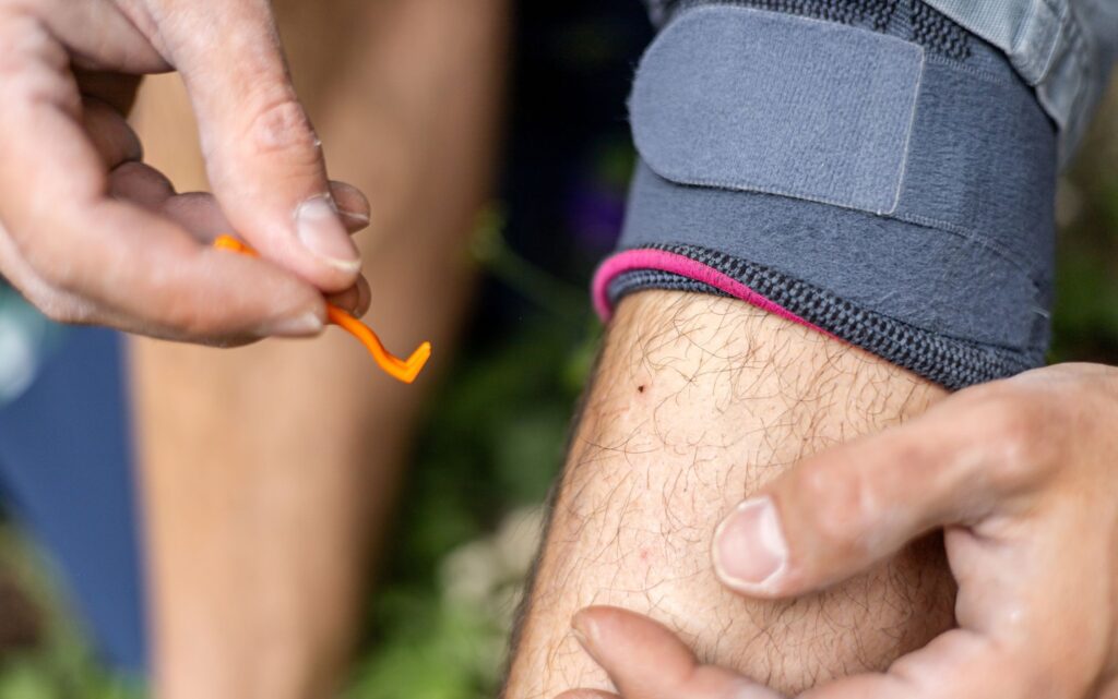 Close-up of a hiker using a tick removal tool to remove an embedded tick