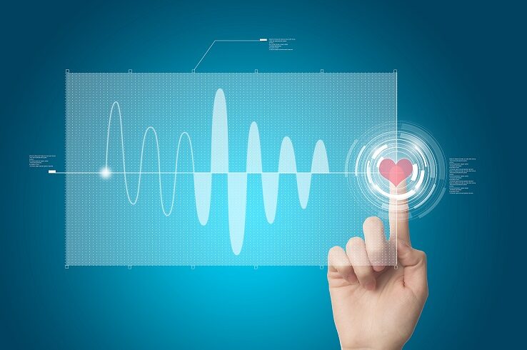 Analysing data on a touch screen