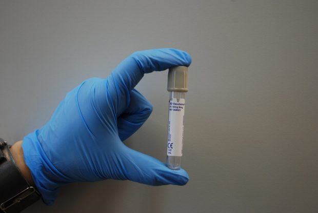 surgical-gloved hand holding empty vacutainer