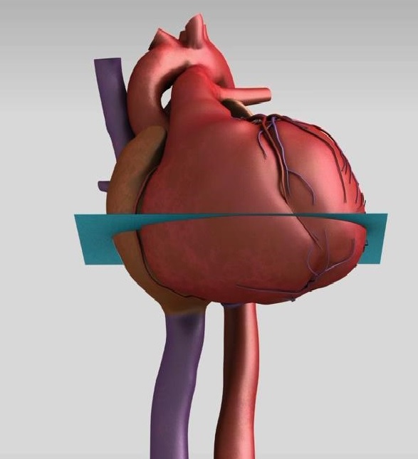 An illustration of an FASP scan.