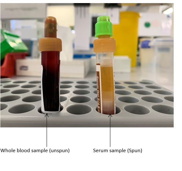 unspun sample and spun sample