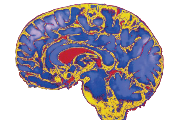 Cross section image of a brain.