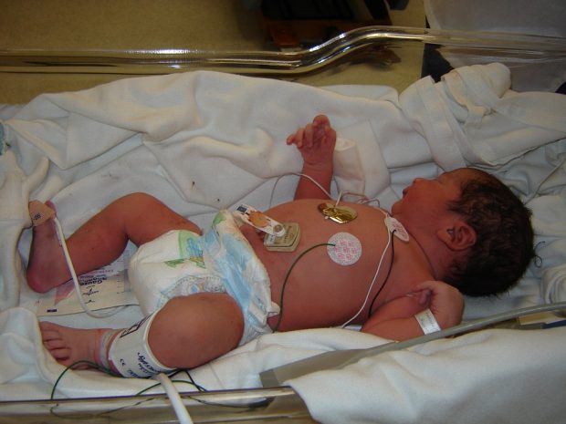 Baby in incubator attached to various monitoring devices