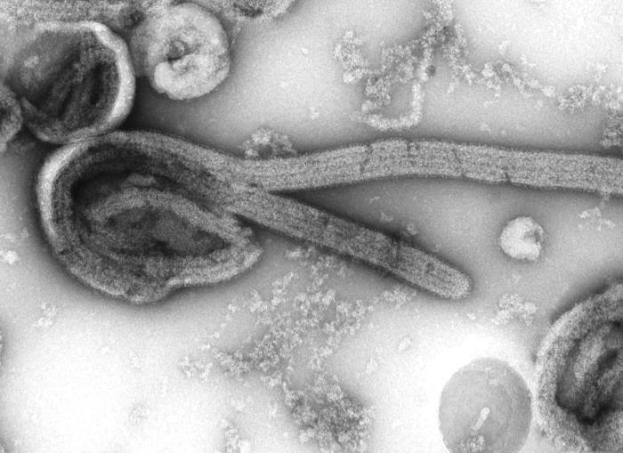 A greyscale image of a electron microscopic image of an isolate of Ebola virus.