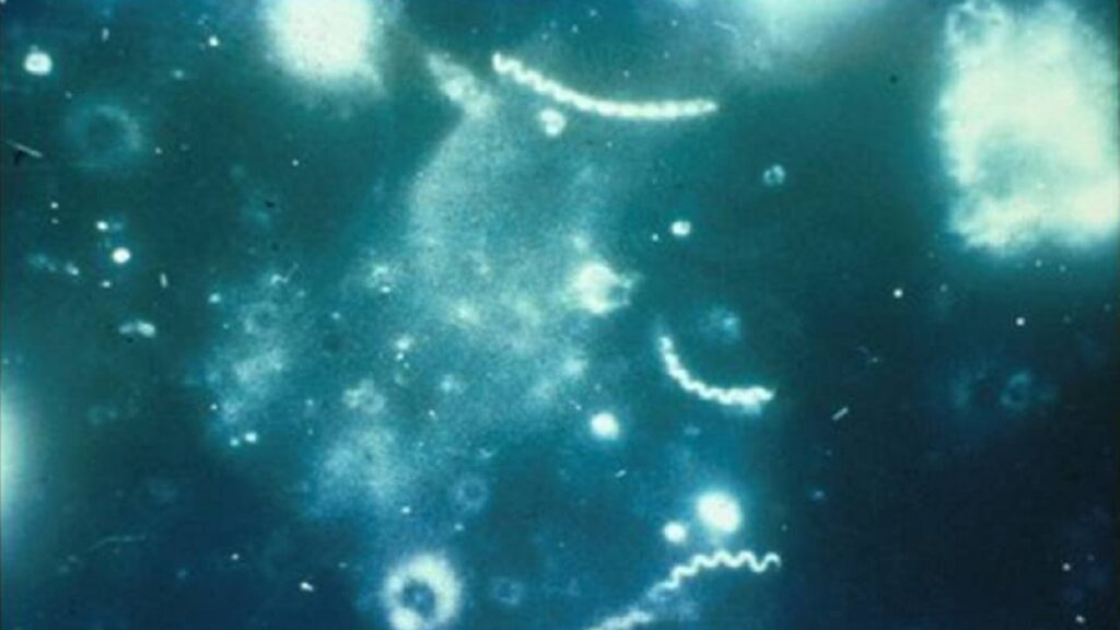 Blue tinted bacteria floating, this is darkfield micrograph of Treponema pallidum.