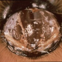Damaged tracheal system of a honey bee infested with Tracheal Mites (Acarapis woodi).