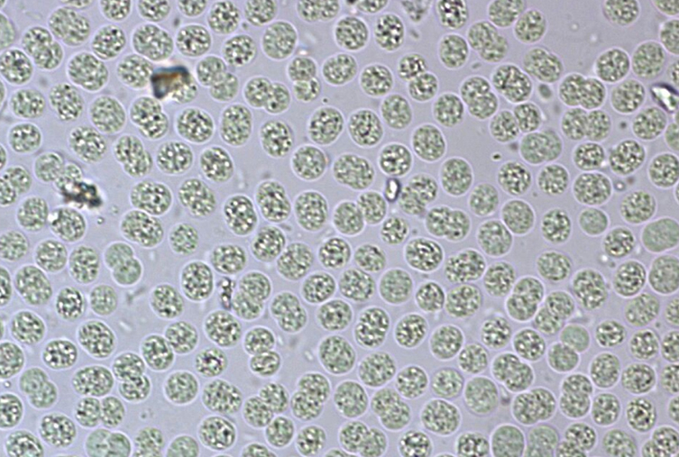 Cyanobacteria