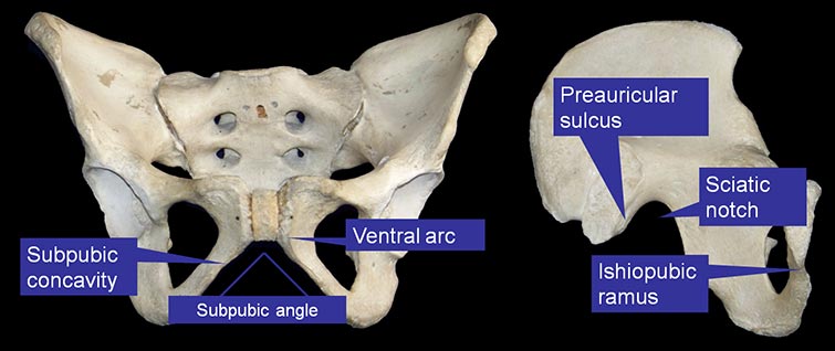 A diagram of the pelvis