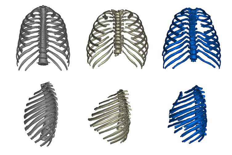 The ribcages of modern humans (left), Turkana Boy (middle) and Neanderthal (right).