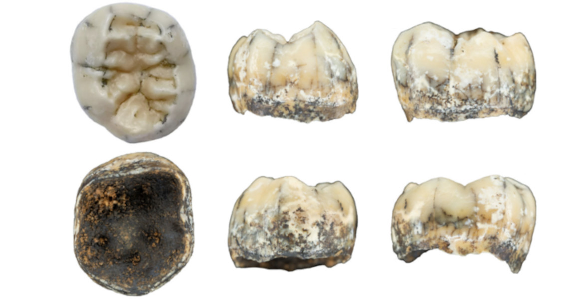 The possible Denisovan tooth, shown from different angles