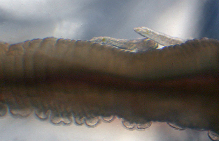 Two tiny male Osedax worms on the trunk of a much larger female.