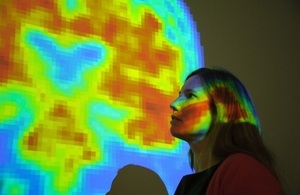 UCL Dementia Research Cente | Crown CopyrightUCL Dementia Research Cente | Crown Copyright