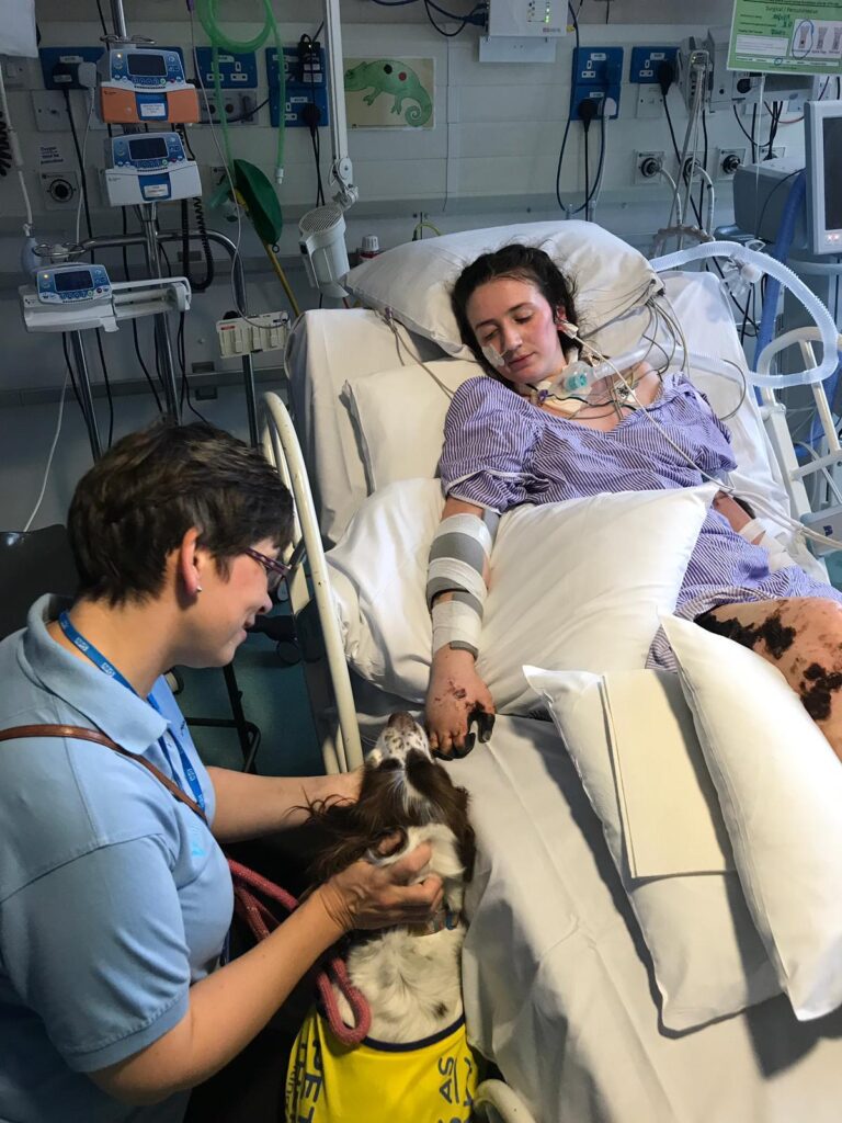Becca Heritage, lying in her hospital bed, being visited by a dog and member of hospital staff.
Becca's fingers, and patches on her legs, are covered in purpuric areas which look like large very dark areas of skin.
